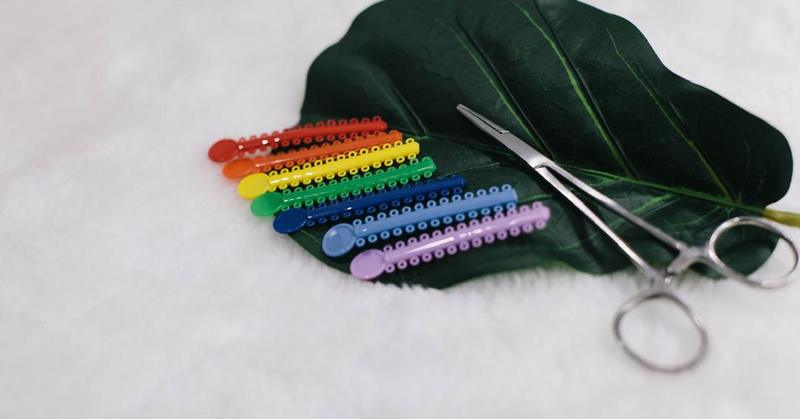 Orthodontic ties and tools used for braces